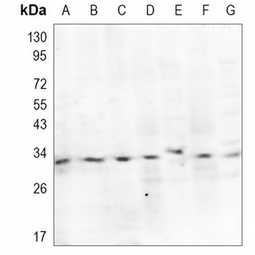 RYBP Rabbit Monoclonal Antibody(C1055)