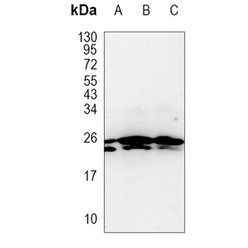 MRPS15 Rabbit Monoclonal Antibody(C1057)