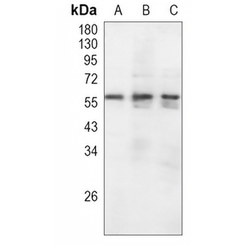 c-Myc Rabbit Monoclonal Antibody(C1058)