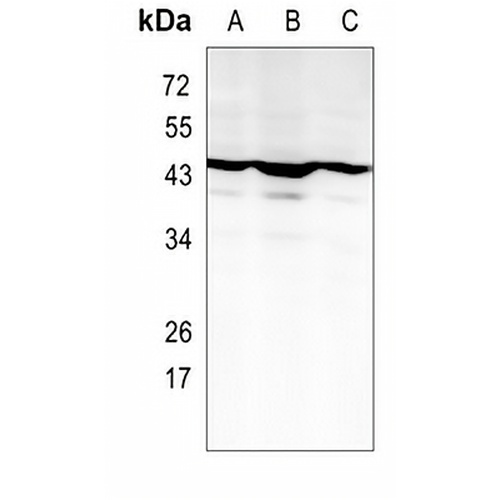 NF-E2 Rabbit Monoclonal Antibody(C1060)