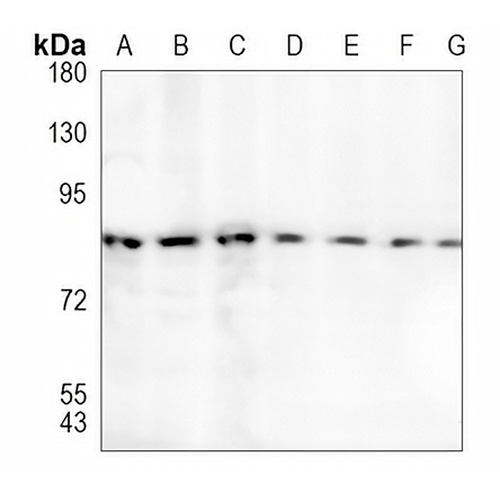 SATB2 Rabbit Monoclonal Antibody(C1061)