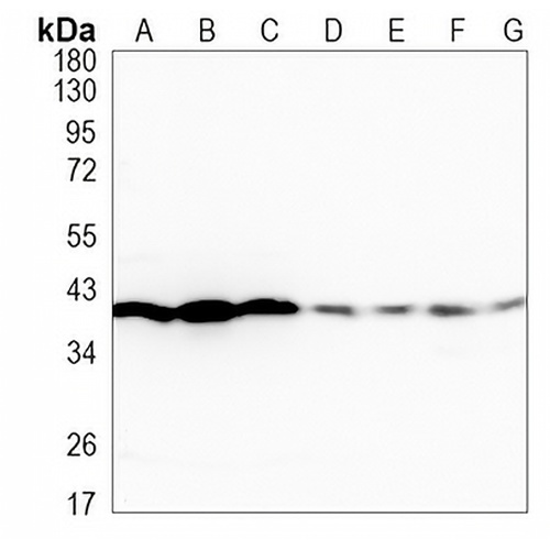 ERK2 Rabbit Monoclonal Antibody(C1062)
