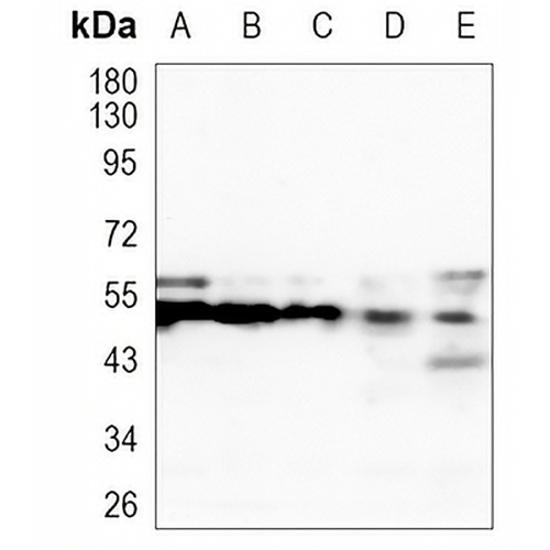 FADS1 Rabbit Monoclonal Antibody(C1063)