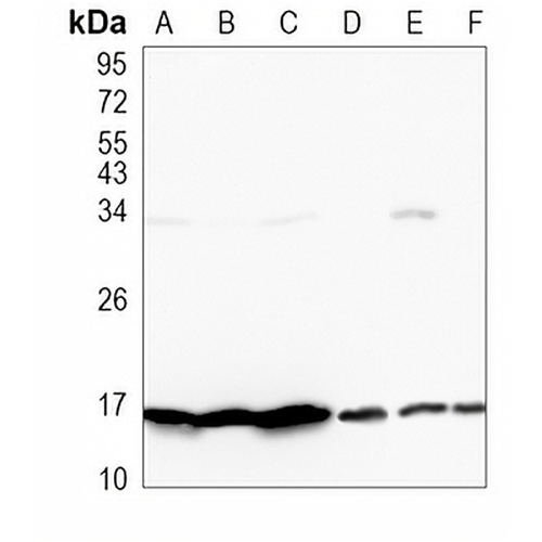 TRAPPC2 Rabbit Monoclonal Antibody(C1064)