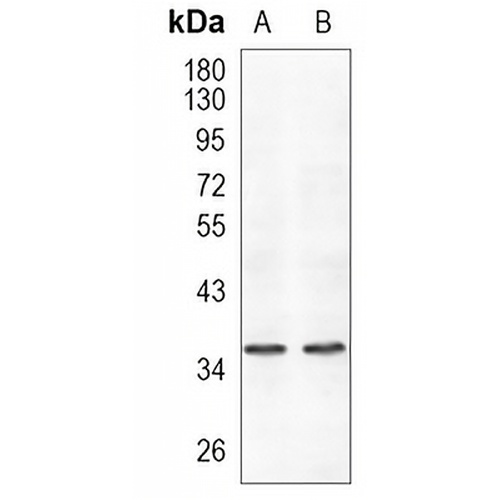 RNF115 Rabbit Monoclonal Antibody(C1065)