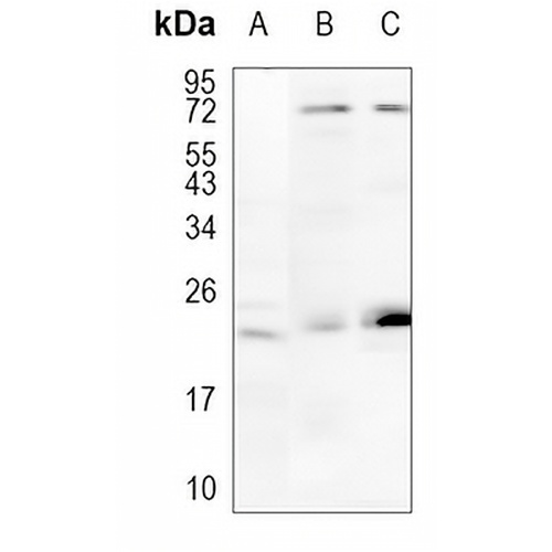 RhoA/B/C Rabbit Monoclonal Antibody(C1068)