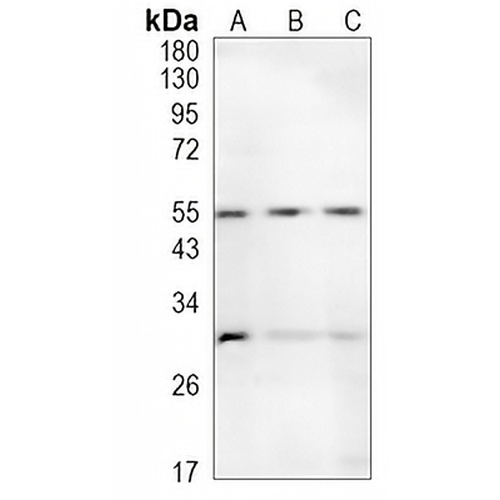 CD47 Rabbit Monoclonal Antibody(C1072)