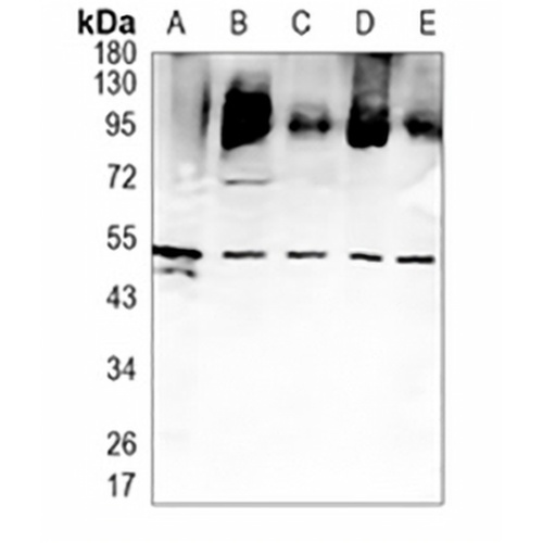 EGR2 Rabbit Monoclonal Antibody(C1073)