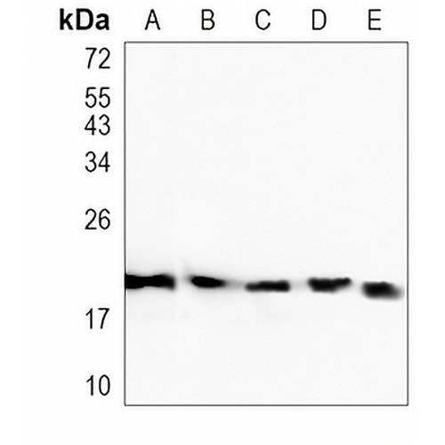 SMAC Rabbit Monoclonal Antibody(C1074)