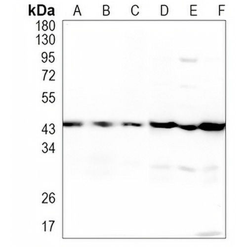 ACAT1 Rabbit Monoclonal Antibody(C1075)
