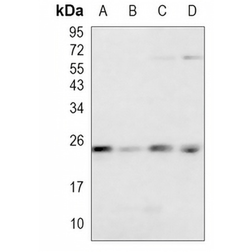 Rab 4A Rabbit Monoclonal Antibody(C1076)