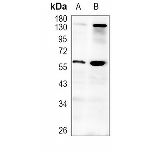 SCP2 Rabbit Monoclonal Antibody(C1077)