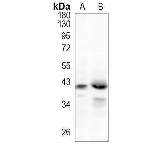 NCK2 Rabbit Monoclonal Antibody(C1078)