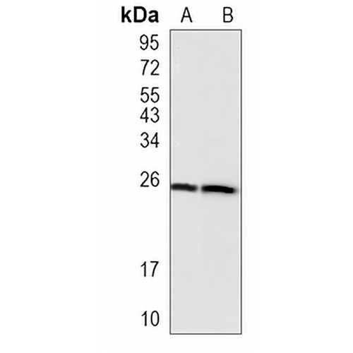 ARFRP1 Rabbit Monoclonal Antibody(C1080)