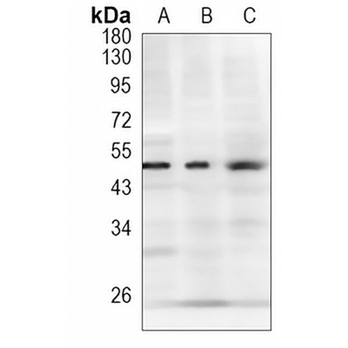 GATA2/3 Rabbit Monoclonal Antibody(C1081)