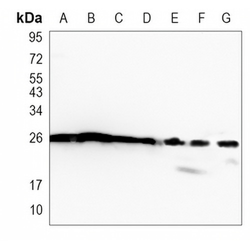HMGB1 Rabbit Monoclonal Antibody(C1082)