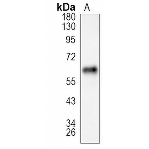p62 Rabbit Monoclonal Antibody(C1088)