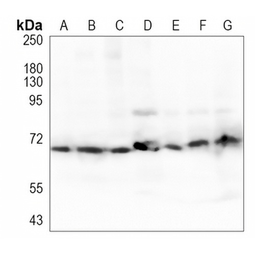 SDHA Rabbit Monoclonal Antibody(C1090)
