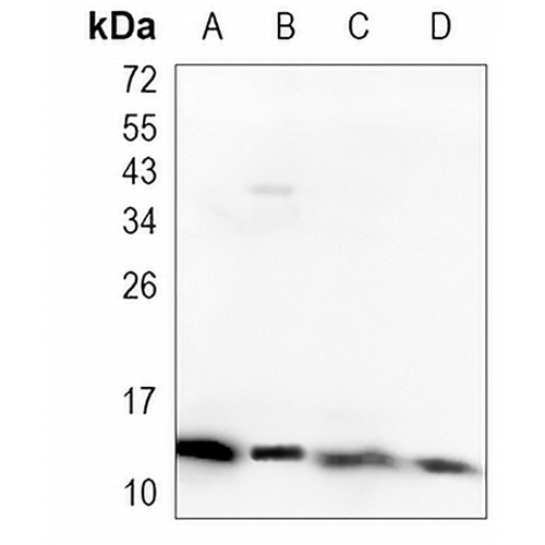 TIP-1 Rabbit Monoclonal Antibody(C1091)