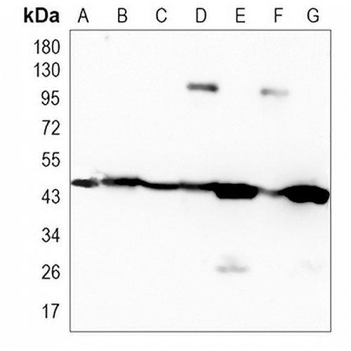 CD142 Rabbit Monoclonal Antibody(C1094)