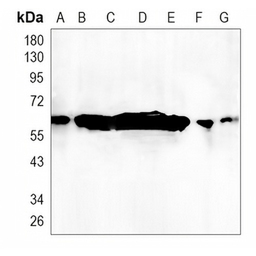 Cytokeratin 9 Rabbit Monoclonal Antibody(C1095)