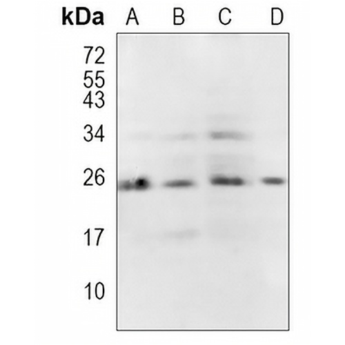 BAG2 Rabbit Monoclonal Antibody(C1097)