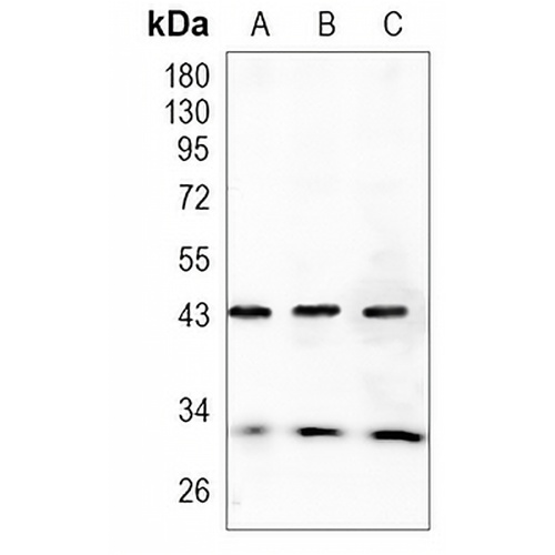 NDRG1 Rabbit Monoclonal Antibody(C1098)