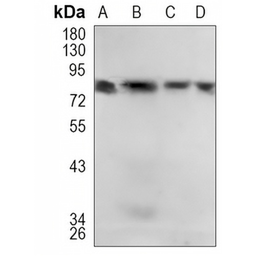 IKK alpha Rabbit Monoclonal Antibody(C1100)