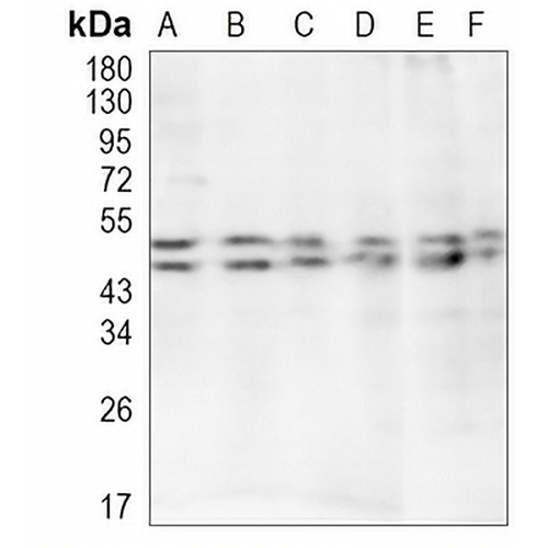 PAX6 Rabbit Monoclonal Antibody(C1101)