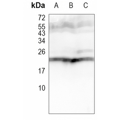 PSMB8 Rabbit Monoclonal Antibody(C1102)