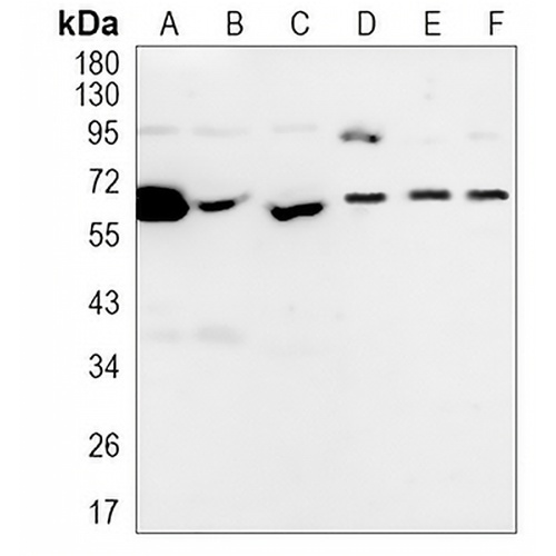 E2F1 Rabbit Monoclonal Antibody(C1103)