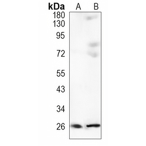 UCH-L3 Rabbit Monoclonal Antibody(C1104)