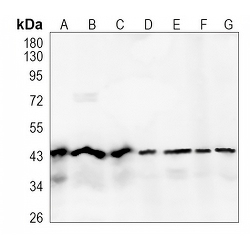 TARDBP Rabbit Monoclonal Antibody(C1105)