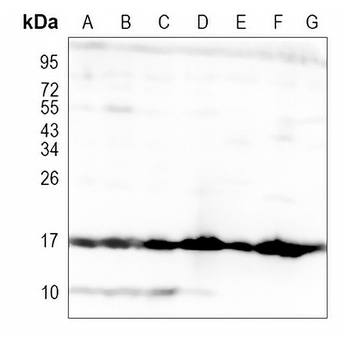 VAMP2 Rabbit Monoclonal Antibody(C1106)