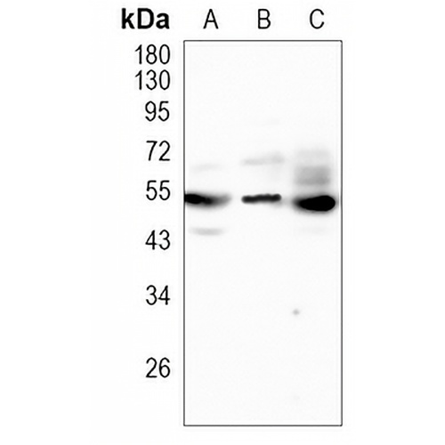PI3K p85 gamma Rabbit Monoclonal Antibody(C1107)