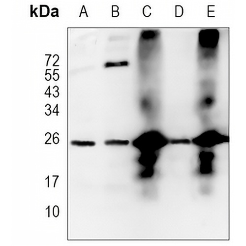 TPPP Rabbit Monoclonal Antibody(C1108)