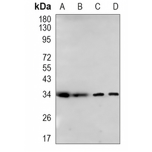 Cyclin D1 Rabbit Monoclonal Antibody(C1112)