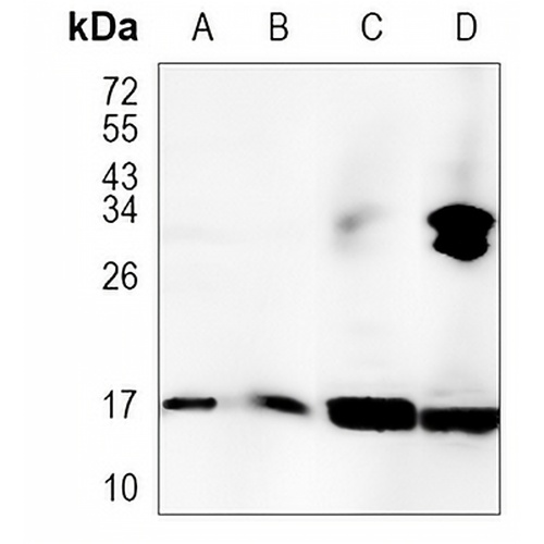 Peroxiredoxin 5 Rabbit Monoclonal Antibody(C1114)