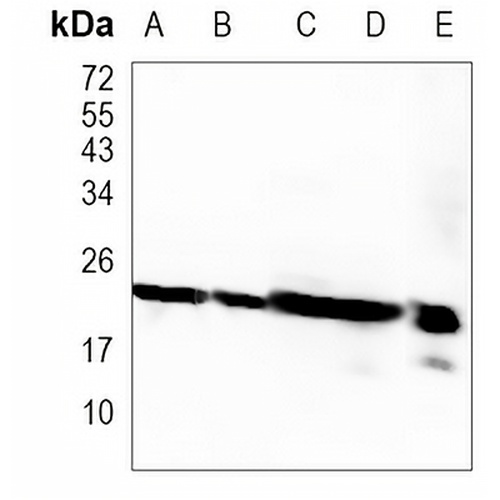 GSTP1 Rabbit Monoclonal Antibody(C1117)
