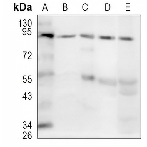 CDT2 Rabbit Monoclonal Antibody(C1118)