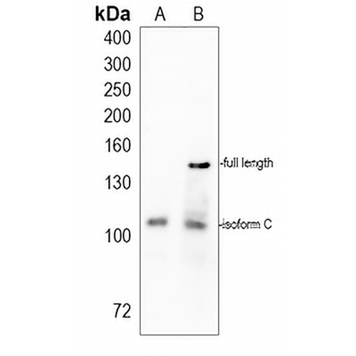 BRD4 Rabbit Monoclonal Antibody(C1119)