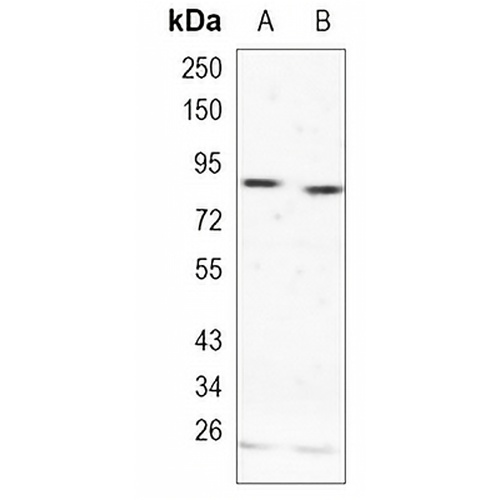 RSK2 Rabbit Monoclonal Antibody(C1120)