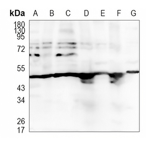 LXR alpha Rabbit Monoclonal Antibody(C1122)