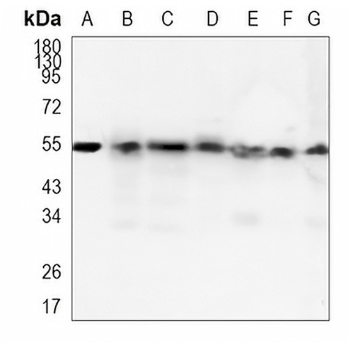 ATG5 Rabbit Monoclonal Antibody(C1123)