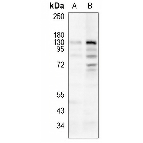 DNMT3A Rabbit Monoclonal Antibody(C1124)