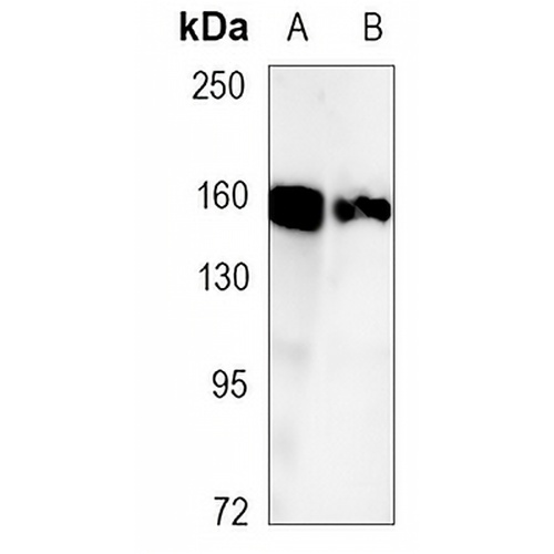 Desmoglein 2 Rabbit Monoclonal Antibody(C1125)