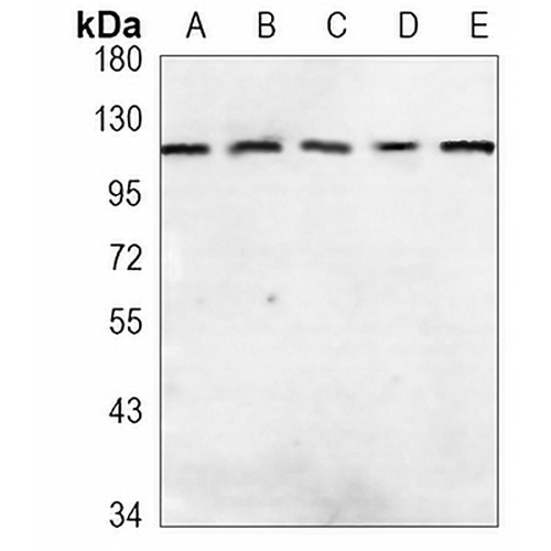 MOV10 Rabbit Monoclonal Antibody(C1126)