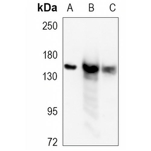 CPS1 Rabbit Monoclonal Antibody(C1127)