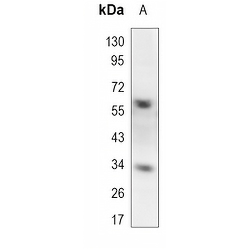 E2F4 Rabbit Monoclonal Antibody(C1128)