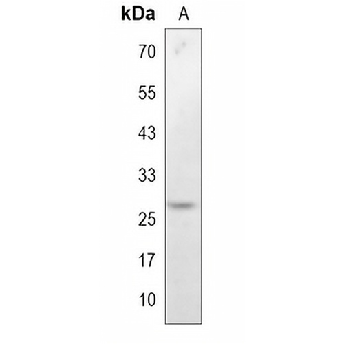 GSC1 Rabbit Monoclonal Antibody(C1129)